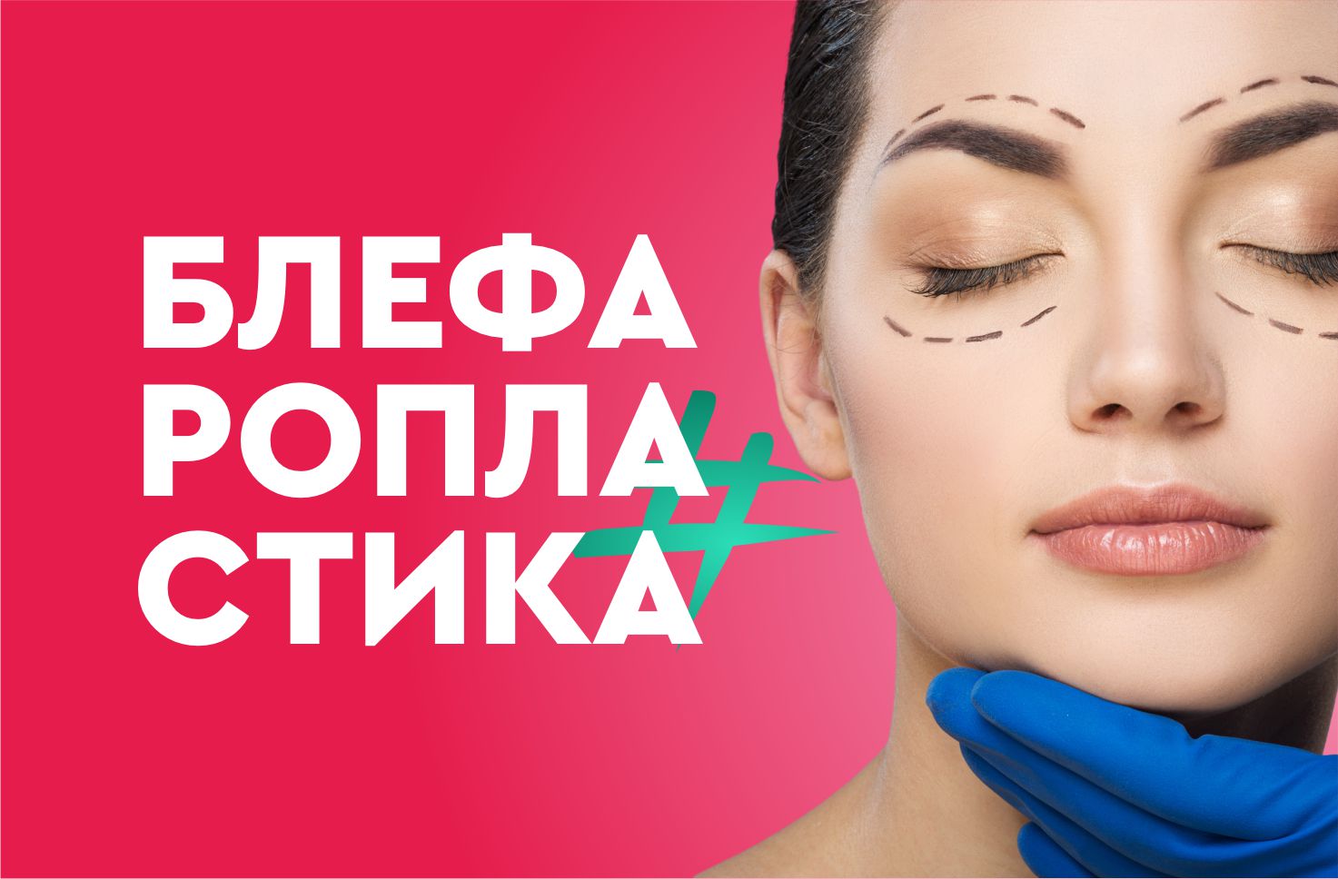 Что такое блефаропластика, зачем нужна и как проводится